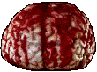 Abnormal Brain